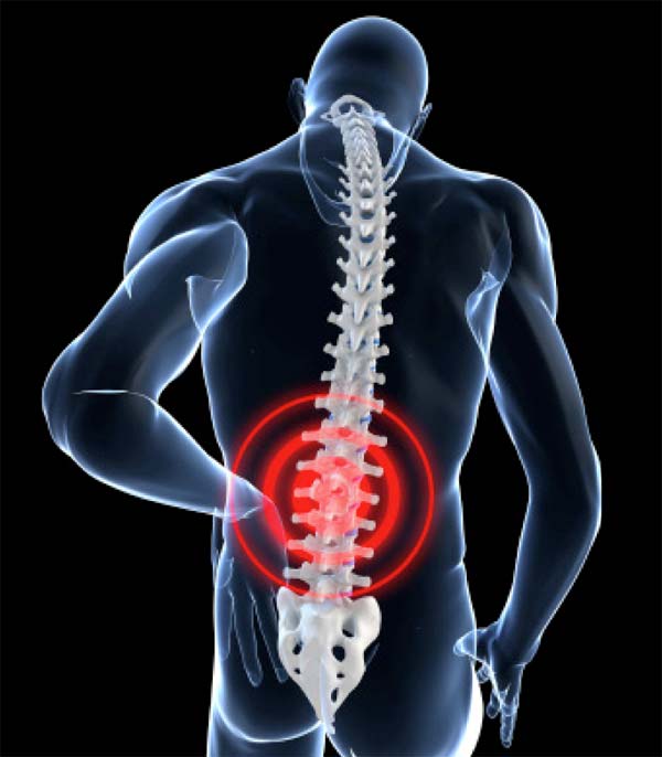 Causes Of Low Back Pain Ways To Alleviate Them Naftulin D O