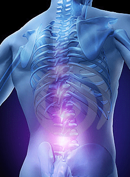 What Causes Back Pain?