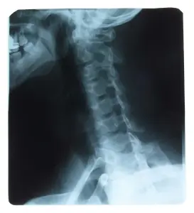 Neck and Spinal X-Ray