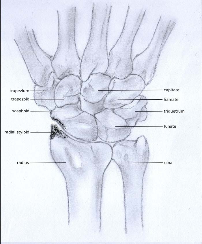 Arthritis Joint Pain. 