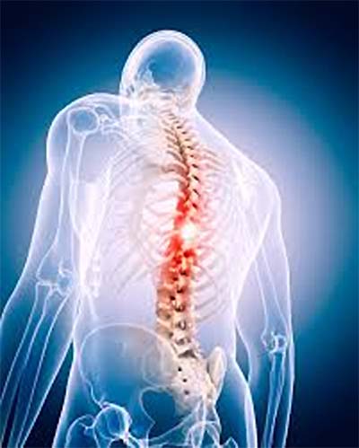 Spinal Cord Stimulation For Failed Back Surgery Patients